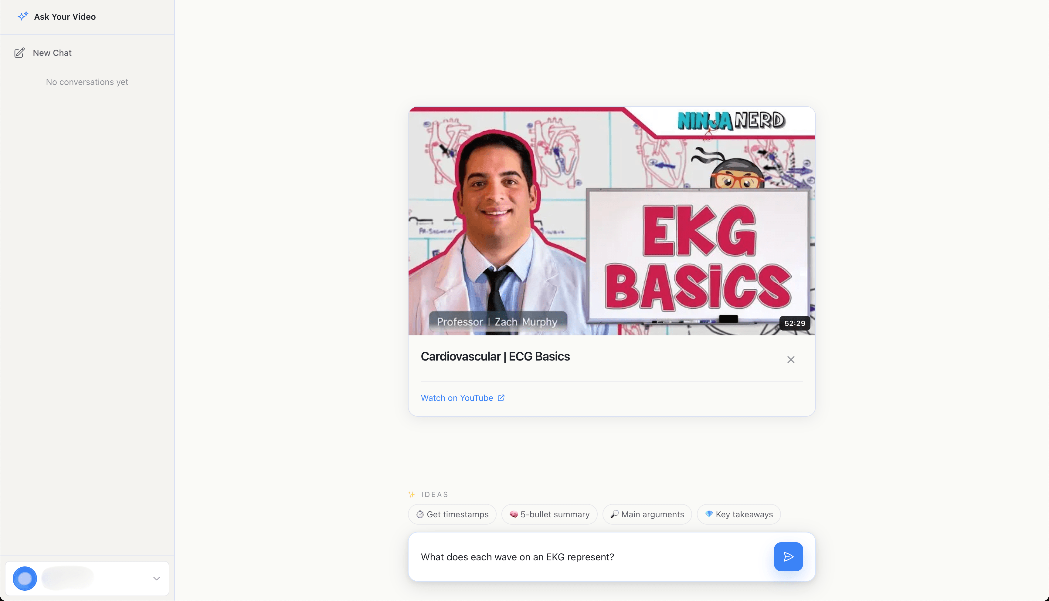 Asking a conceptual question about EKG waves