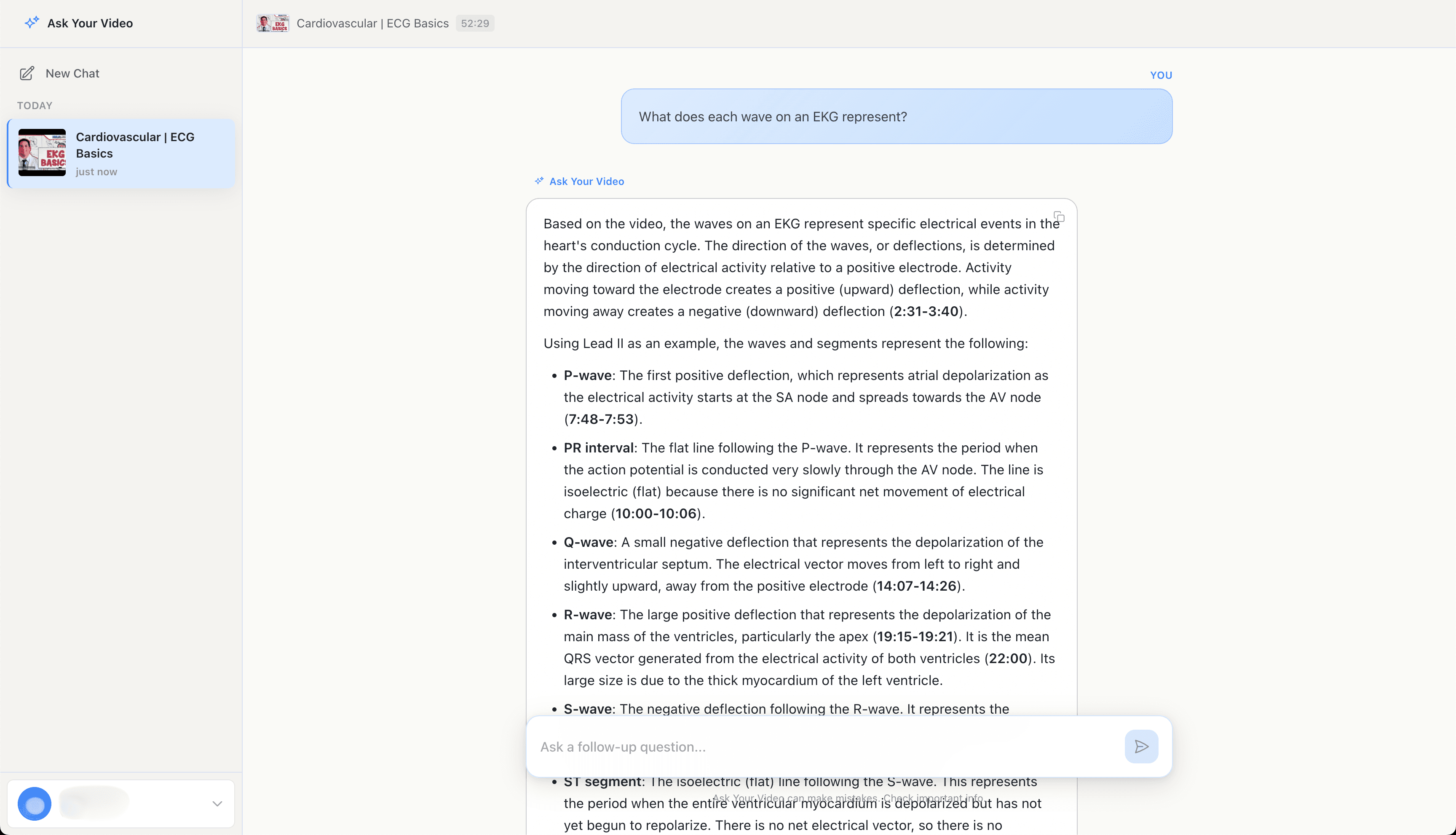 AI explanation of EKG waves with lecture timestamps for each concept